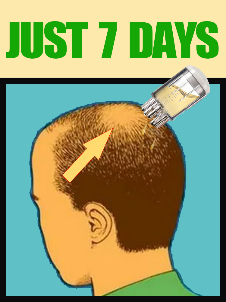 2025 NEW UPGRADE Scalp Applica - огляд і ціна Hair Care Oil Serum