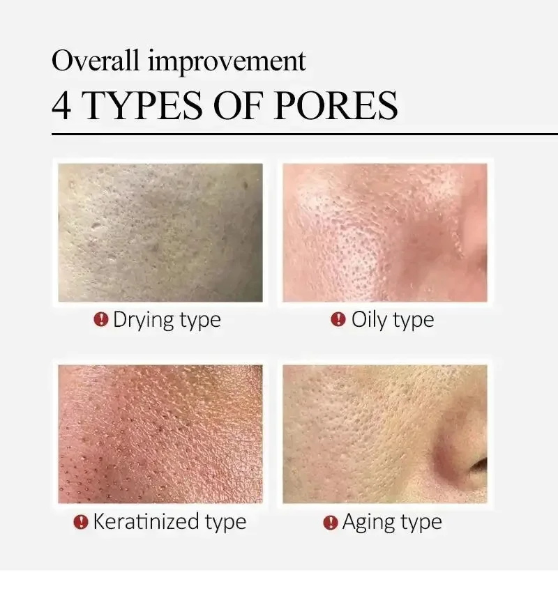 Centella Asiatica Shrink Pores - огляд і ціна Silk Press Serum