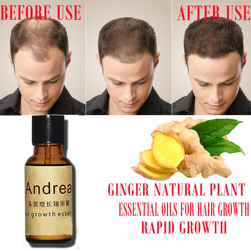 2/5/10Pcs Andrea Hair Growth S - огляд і ціна Hair Care Herbal