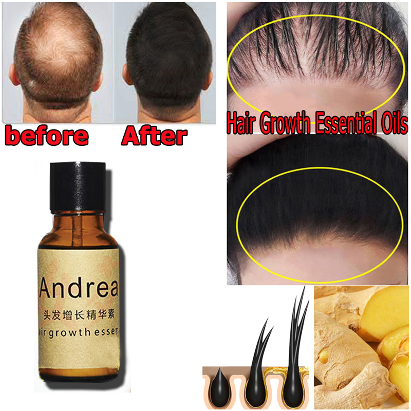 2/5/10Pcs Andrea Hair Growth S - огляд і ціна Hair Care Herbal
